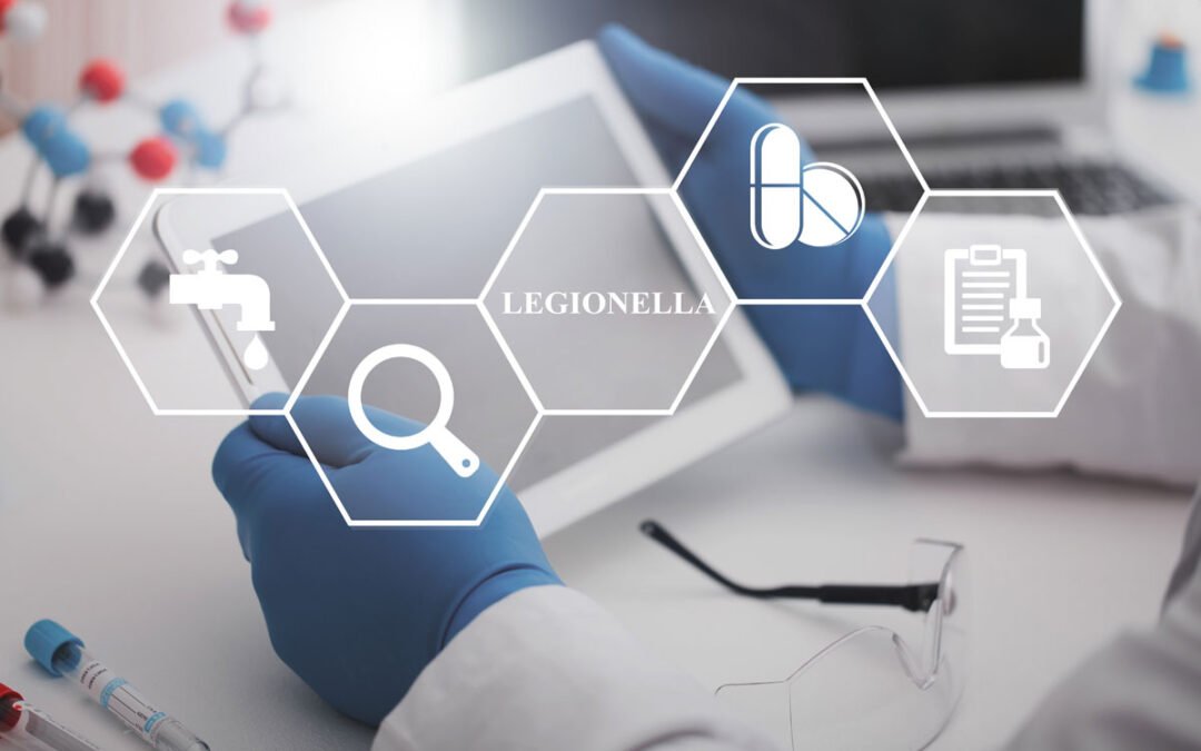 ¿Qué negocios deben realizar un control de legionella en zaragoza?